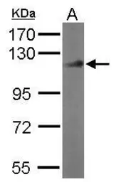 Anti-DDB1 antibody [N1N3] used in Western Blot (WB). GTX100129