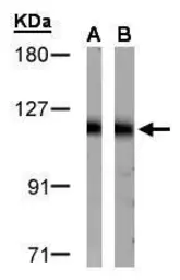 Anti-DDB1 antibody [N1N3] used in Western Blot (WB). GTX100129