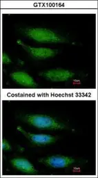 Anti-FANCG antibody [N1N3] used in Immunocytochemistry/ Immunofluorescence (ICC/IF). GTX100164