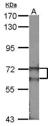 Anti-FANCG antibody [N1N3] used in Western Blot (WB). GTX100164