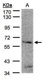 Anti-FANCG antibody [N1N3] used in Western Blot (WB). GTX100164