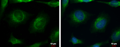 Anti-Cav beta 4 antibody [C3], C-term used in Immunocytochemistry/ Immunofluorescence (ICC/IF). GTX100202