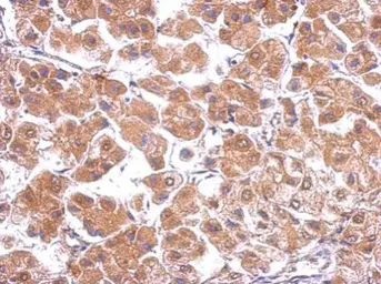 Anti-Cav beta 4 antibody [C3], C-term used in IHC (Paraffin sections) (IHC-P). GTX100202