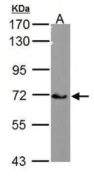 Anti-Cav beta 4 antibody [C3], C-term used in Western Blot (WB). GTX100202