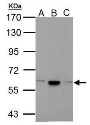 Anti-Cav beta 4 antibody [C3], C-term used in Western Blot (WB). GTX100202