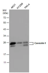 Anti-Caveolin 1 antibody [N1N3] used in Western Blot (WB). GTX100205