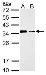 Anti-CIS antibody [C2C3], C-term used in Western Blot (WB). GTX100216