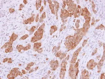 Anti-NQO1 antibody [C2C3], C-term used in IHC (Paraffin sections) (IHC-P). GTX100235