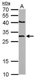 Anti-NQO1 antibody [C2C3], C-term used in Western Blot (WB). GTX100235