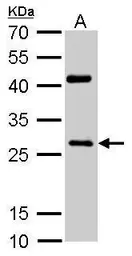 Anti-NQO1 antibody [C2C3], C-term used in Western Blot (WB). GTX100235