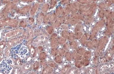 Anti-NQO1 antibody [C2C3], C-term used in IHC (Paraffin sections) (IHC-P). GTX100235