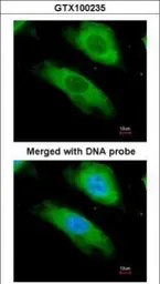 Anti-NQO1 antibody [C2C3], C-term used in Immunocytochemistry/ Immunofluorescence (ICC/IF). GTX100235