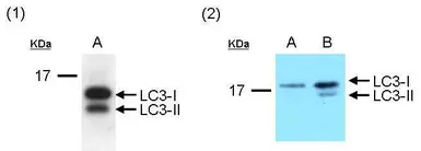 Anti-LC3B antibody used in Western Blot (WB). GTX100240