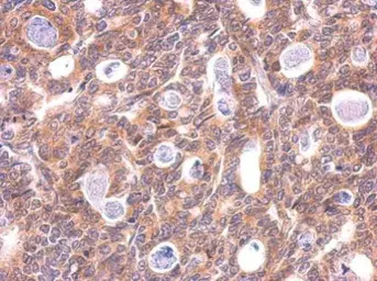 Anti-LC3B antibody used in IHC (Paraffin sections) (IHC-P). GTX100240