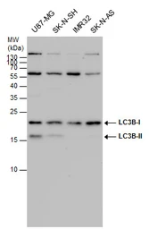 Anti-LC3B antibody used in Western Blot (WB). GTX100240