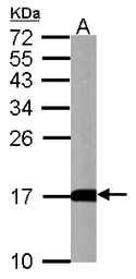 Anti-LC3B antibody used in Western Blot (WB). GTX100240