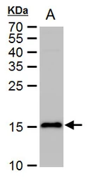 Anti-LC3B antibody used in Western Blot (WB). GTX100240