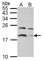 Anti-LC3B antibody used in Western Blot (WB). GTX100240