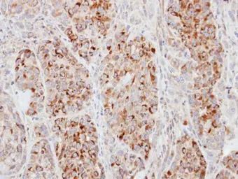 Anti-ECT2 antibody [N1], N-term used in IHC (Paraffin sections) (IHC-P). GTX100248