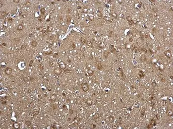 Anti-FACL4 antibody [C3], C-term used in IHC (Paraffin sections) (IHC-P). GTX100260