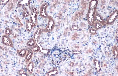 Anti-FACL4 antibody [C3], C-term used in IHC (Paraffin sections) (IHC-P). GTX100260