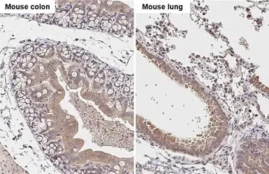 Anti-FACL4 antibody [C3], C-term used in IHC (Paraffin sections) (IHC-P). GTX100260