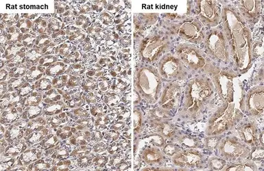 Anti-FACL4 antibody [C3], C-term used in IHC (Paraffin sections) (IHC-P). GTX100260