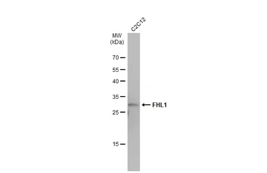 Anti-FHL1 antibody used in Western Blot (WB). GTX100266