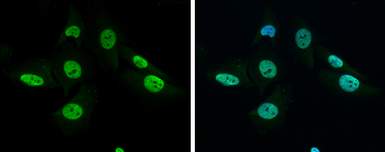 Anti-GRB2 antibody used in Immunocytochemistry/ Immunofluorescence (ICC/IF). GTX100294