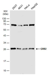 Anti-GRB2 antibody used in Western Blot (WB). GTX100294