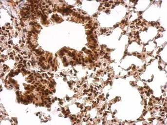 Anti-GRB2 antibody used in IHC (Paraffin sections) (IHC-P). GTX100294