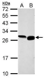 Anti-GRB2 antibody used in Western Blot (WB). GTX100294