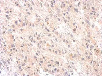 Anti-Factor H antibody [N3C1], Internal used in IHC (Paraffin sections) (IHC-P). GTX100305