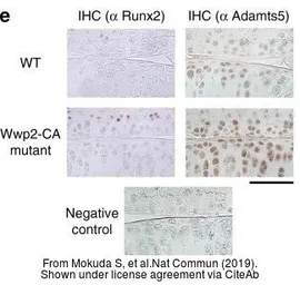 Anti-ADAMTS5 antibody used in IHC (Paraffin sections) (IHC-P). GTX100332