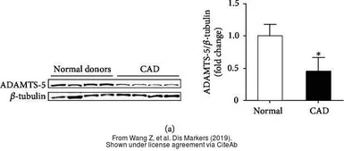 Anti-ADAMTS5 antibody used in Western Blot (WB). GTX100332