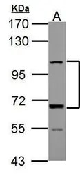 Anti-ADAMTS5 antibody used in Western Blot (WB). GTX100332