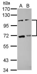 Anti-ADAMTS5 antibody used in Western Blot (WB). GTX100332