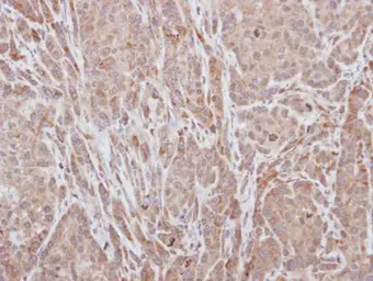 Anti-ADAMTS5 antibody used in IHC (Paraffin sections) (IHC-P). GTX100332