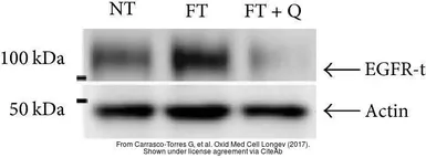 Anti-EGFR antibody [C2C3], C-term used in Western Blot (WB). GTX100448