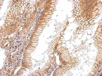 Anti-EGFR antibody [C2C3], C-term used in IHC (Paraffin sections) (IHC-P). GTX100448