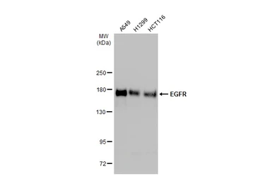 Anti-EGFR antibody [C2C3], C-term used in Western Blot (WB). GTX100448