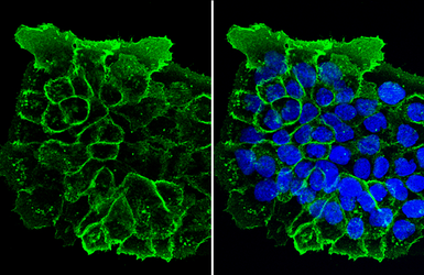 Anti-EGFR antibody [C2C3], C-term used in Immunocytochemistry/ Immunofluorescence (ICC/IF). GTX100448