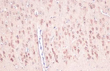 Anti-IGFBP3 antibody [N2C3] used in IHC (Paraffin sections) (IHC-P). GTX100454