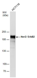 Anti-Her2 / ErbB2 antibody used in Western Blot (WB). GTX100509