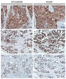 Anti-Her2 / ErbB2 antibody used in IHC (Paraffin sections) (IHC-P). GTX100509