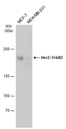 Anti-Her2 / ErbB2 antibody used in Western Blot (WB). GTX100509