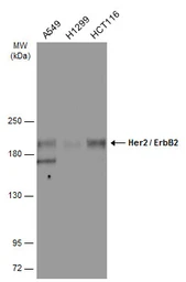 Anti-Her2 / ErbB2 antibody used in Western Blot (WB). GTX100509