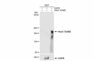 Anti-Her2 / ErbB2 antibody used in Western Blot (WB). GTX100509