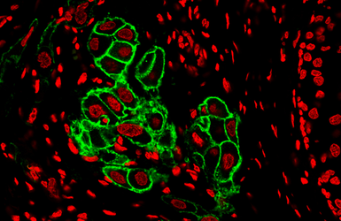 Anti-Her2 / ErbB2 antibody used in IHC (Paraffin sections) (IHC-P). GTX100509