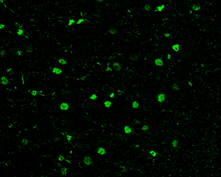 Anti-HDAC1 antibody used in IHC (Paraffin sections) (IHC-P). GTX100513